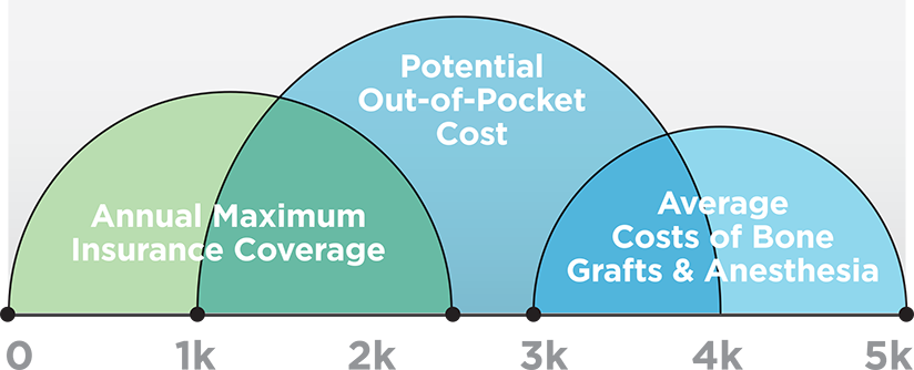 Bottom Line Dental Implant Costs Bottom Line Dental Implant Costs
